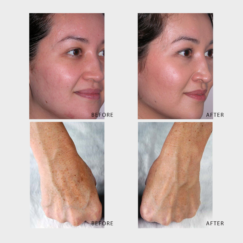 tishara salon tratament corporal facial velashape intraceuticals coolifting thalgo119